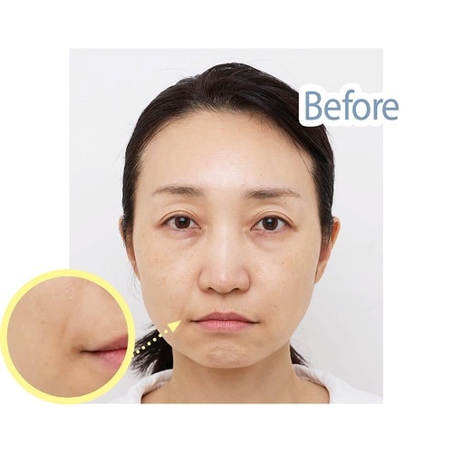 Before イメージ