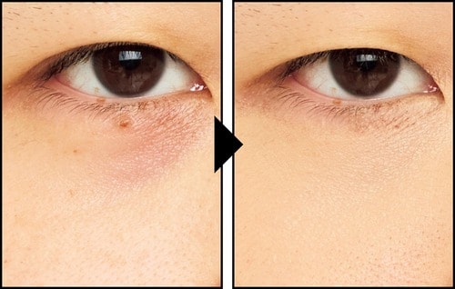 コンシーラーでクマを隠した様子