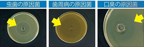 虫歯・歯周病・口臭の原因菌全てに高い抗菌力を発揮 歯磨き粉おすすめ イメージ