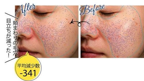 ベストのワケ:使用したモニター全員の毛穴に効果アリ! イメージ