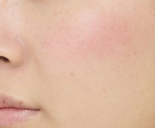 【ツヤ感】ムラになってツヤ感が不均等に チークおすすめ イメージ