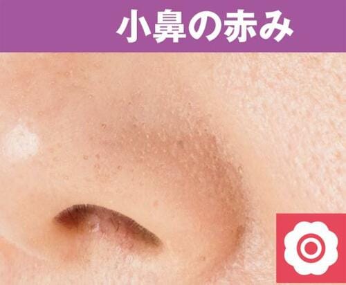 シミのカバー力はさすが!薄く伸ばすのがポイント コンシーラーおすすめ イメージ3