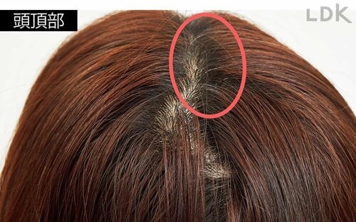 いつものセルフ染め 白髪染めヘアカラーおすすめ イメージ