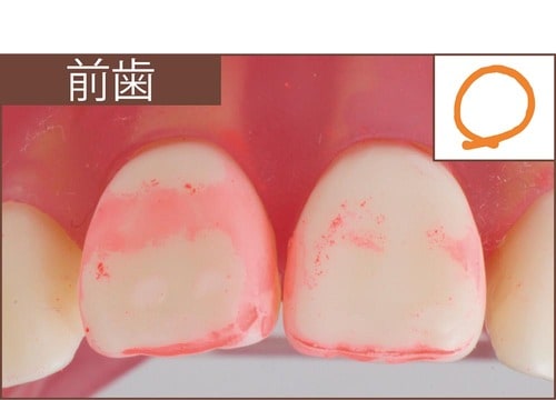 汚れ落ち：評価A イメージ