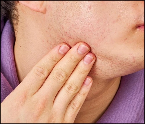 【剃りやすさ】軽めのテクスチャーですんなり伸びた! シェービングジェルおすすめ イメージ2