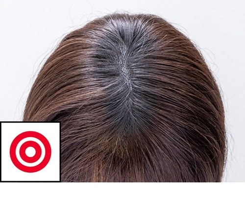 【仕上がり】 増毛パウダーおすすめ イメージ