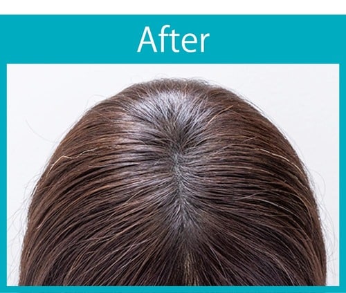 【仕上がり】わざとらしくなく地肌をカバーできた 増毛パウダーおすすめ イメージ2