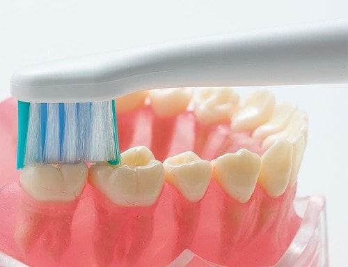 【電動歯ブラシの当て方】押し付けない、動かさない 安い電動歯ブラシおすすめ イメージ