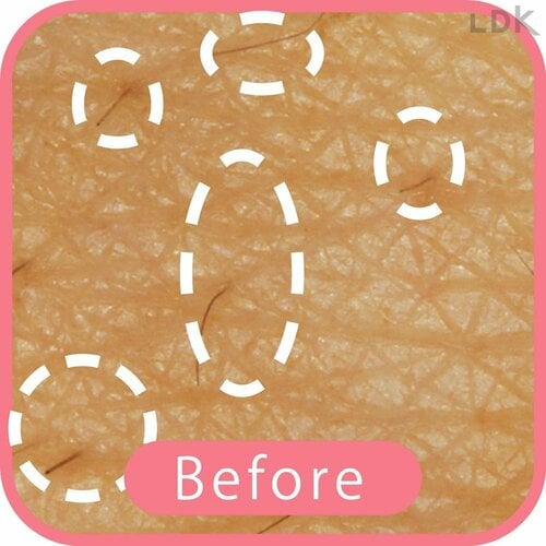 Before 女性用T字カミソリおすすめ イメージ
