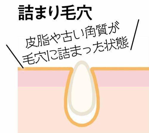ベストな毛穴ケアとは? ビタミンC化粧水おすすめ イメージ