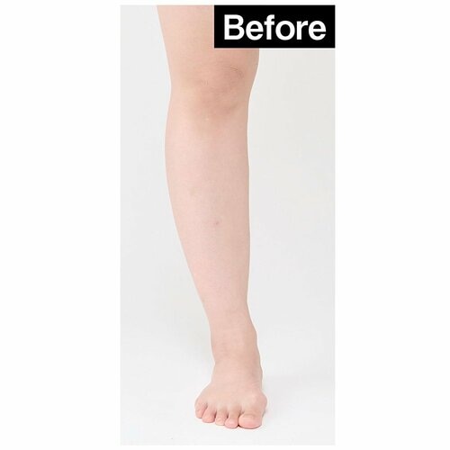 Before 着圧ソックスおすすめ イメージ