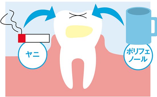 2種類の黄ばみのうち「内因性」に電動歯ブラシは効きません