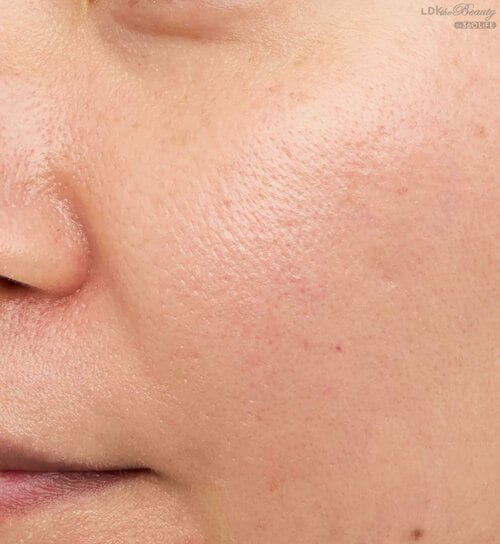 色ムラが少し落ち着いた程度 乾燥肌向け保湿化粧下地おすすめ イメージ