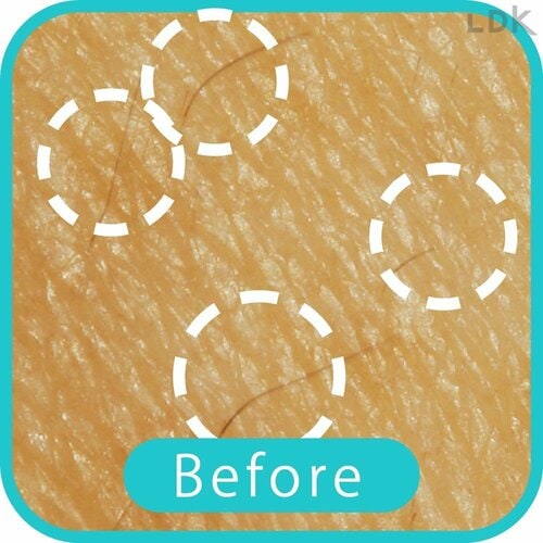 Before 女性用電気シェーバーおすすめ イメージ
