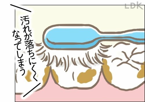 歯ブラシはどのくらいの頻度で交換すればいいですか？ 歯ブラシおすすめ イメージ