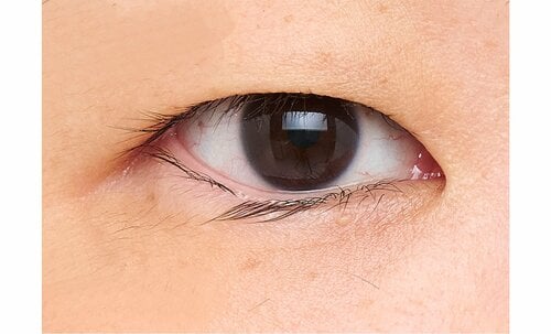 before アイプチおすすめ イメージ