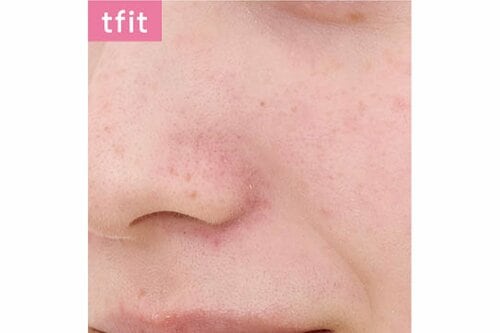 ティーフィット「トランスルーセント セットフィニッシングパウダー/04 ラベンダー」を塗布した後の肌の画像