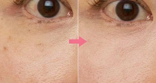 Before→After パレットコンシーラーおすすめ イメージ