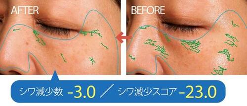 テスト1:しわ目立ち度