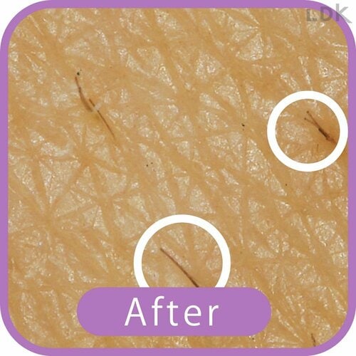 After VIOシェーバーおすすめ イメージ