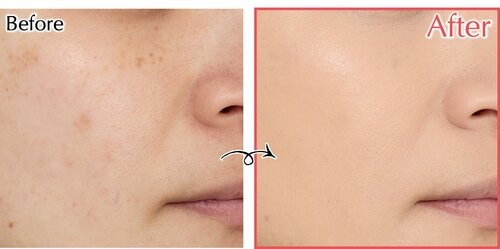 Before/After クッションファンデおすすめ イメージ