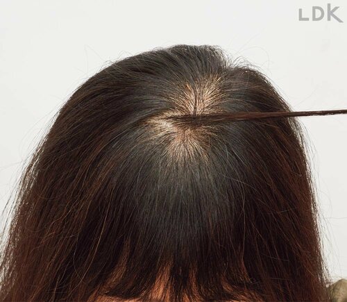 STEP1:分け目の左の髪をひと束、右に倒す 生え際隠しおすすめ イメージ