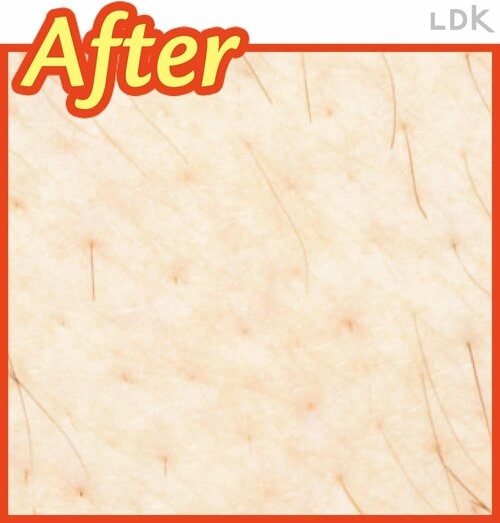 After VIOシェーバーおすすめ イメージ