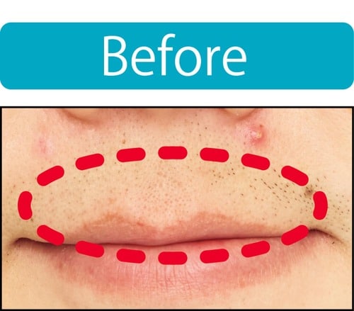 【青ヒゲ隠し】粉っぽくならず薄くできた メンズコンシーラーおすすめ イメージ