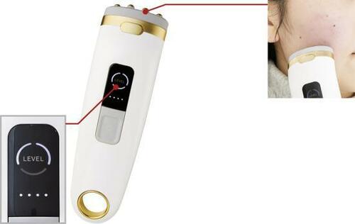 コスビューティーの美顔器で顔のたるみを改善！ イメージ2