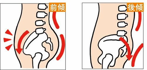 お腹・お尻に肉がつきがちなのは骨盤のゆがみが原因