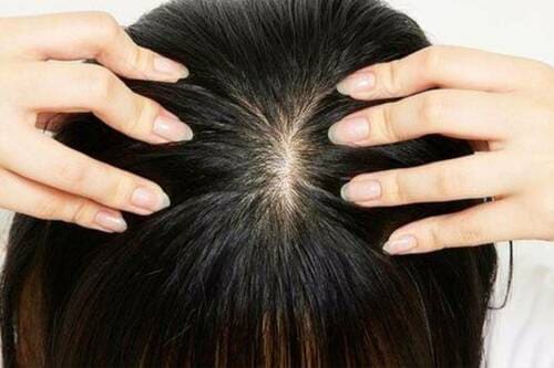 選び方3:敏感肌の人はやさしくケアできるものを選ぶ 女性用育毛剤おすすめ イメージ