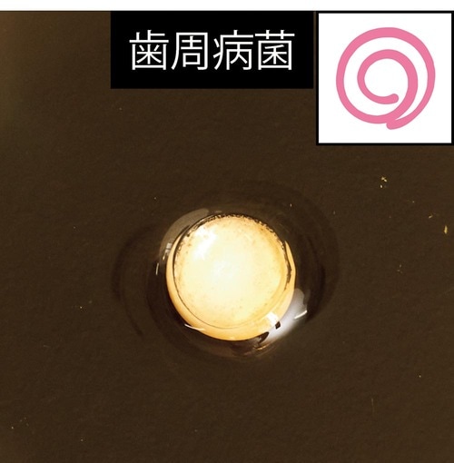 虫歯や歯周病の原因菌もブロック イメージ2