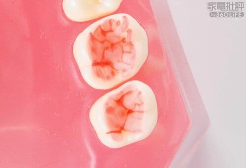 Before 安い電動歯ブラシおすすめ イメージ