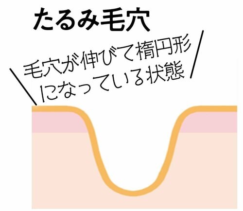 ベストな毛穴ケアとは? ビタミンC化粧水おすすめ イメージ3