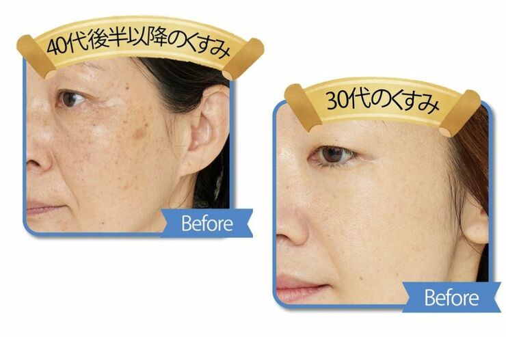 30代と40代ではカラー下地を変えないとくすみ続ける（泣）上手に隠せる方法を紹介