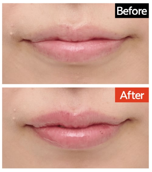 仕上がり：一気にボリュームと血色感が跳ね上がる リッププランパーおすすめ イメージ