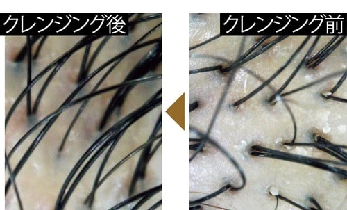 汗をかく季節はセルフで行う価値あり 頭皮クレンジングおすすめ イメージ