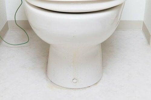 便器の隙間が、気付くと真っ黒…サンポールパックで尿シミ撃退！ イメージ