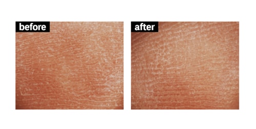 角質ケア ボディスクラブおすすめ イメージ