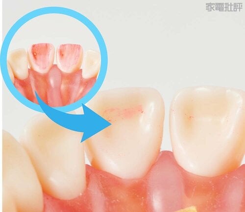前歯の裏 電動歯ブラシおすすめ イメージ