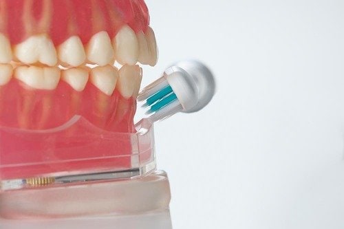 【電動歯ブラシの角度】面は90度、歯と歯茎の間は45度 安い電動歯ブラシおすすめ イメージ2