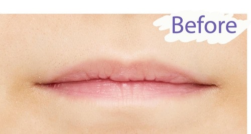 Before/色明るめの唇 ローズリップおすすめ イメージ