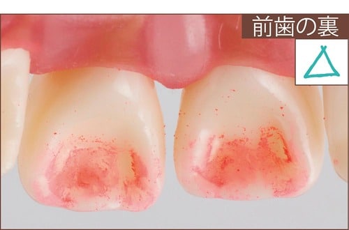 汚れ落ち：評価C イメージ3