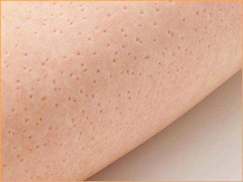 肌に残るあとが鋭さを物語っている ツボ押しグッズおすすめ イメージ