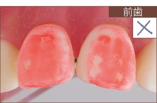 汚れ落ち：評価C イメージ2