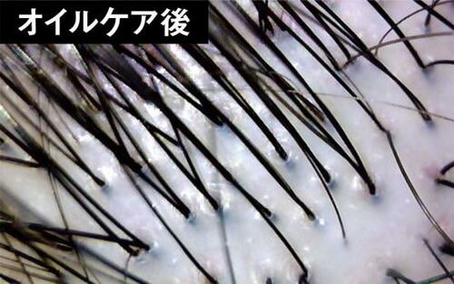 洗浄力の強いシャンプーではなくオイルケアで毛穴詰まりを解消!
