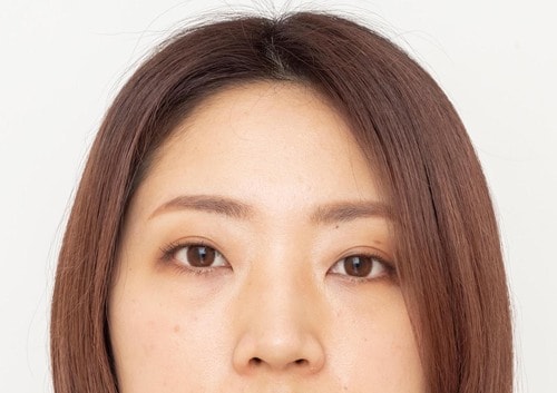 Before カーラーのおすすめおすすめ イメージ