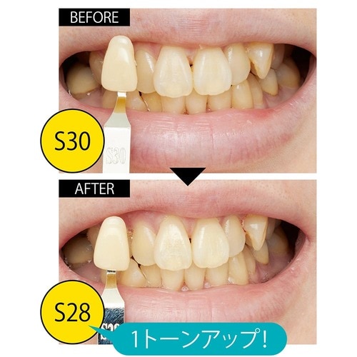 判定:まあまあ 貼りやすく光の反射で白さがちょい増し「ティースホワイトパック」 イメージ2