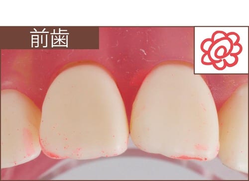 汚れ落ち：評価A イメージ