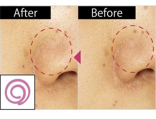 確かに毛穴が目立たなくなった! イメージ